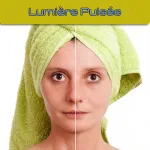 Unité de lumière pulsée pro modèle 2013