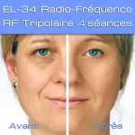 Appareil pour esthetique 5 fonctions au choix